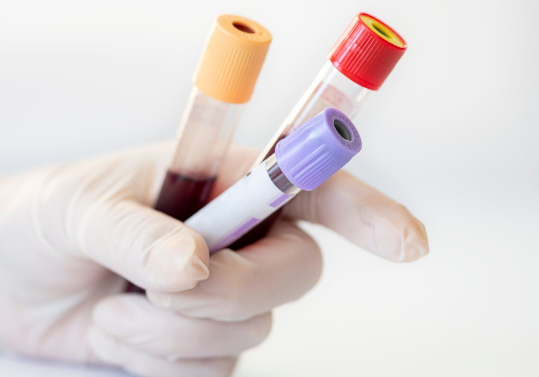 Gloved hand holding blood sample tubes, illustrating what is OPIM and the need for proper handling in healthcare.