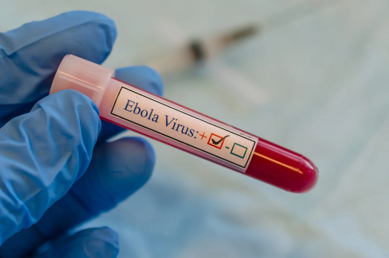 image of an ebola test tube with the positive result marked