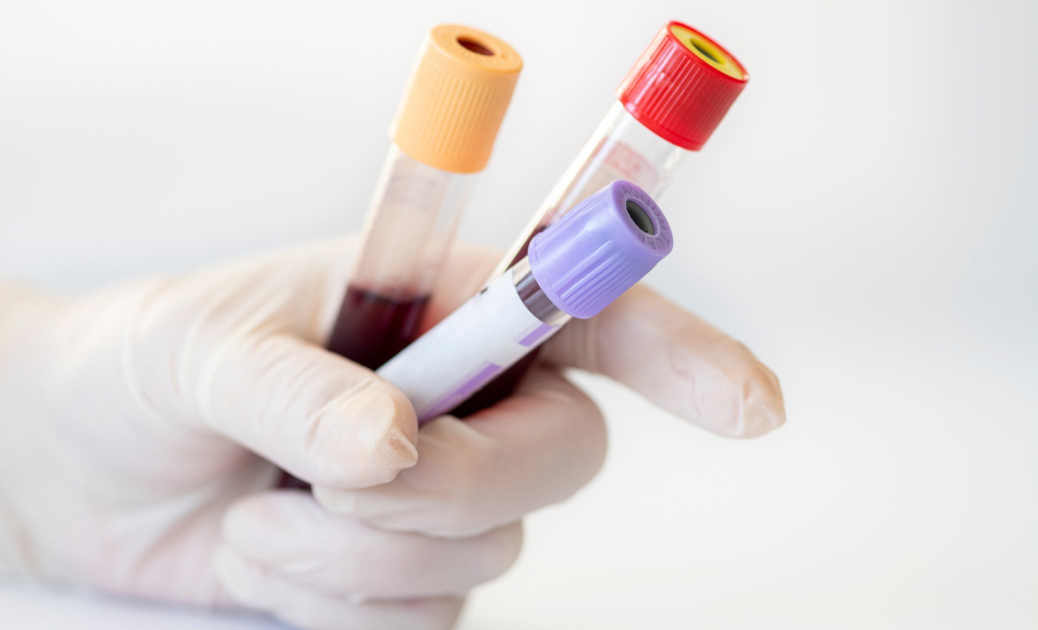 Gloved hand holding blood sample tubes, illustrating what is OPIM and the need for proper handling in healthcare.